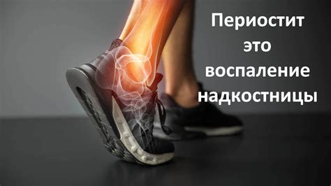 Как справиться с болью в коленном суставе после бега
